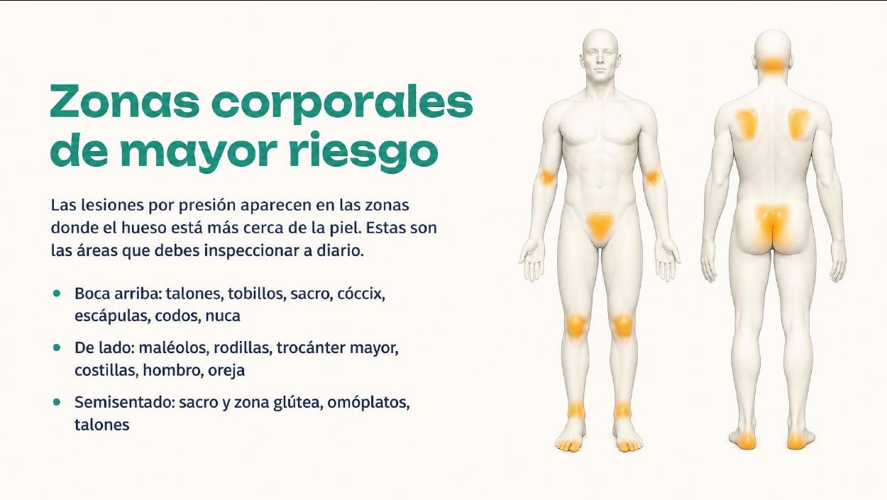 Página interior del manual: Mapa corporal de zonas de riesgo